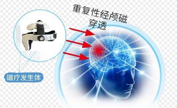 脑出血治疗仪