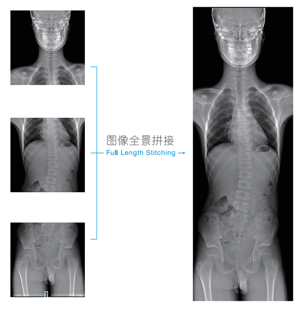 DR仪成像